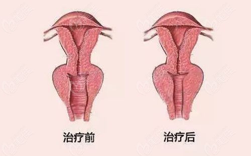 西宁私密紧缩好的医院