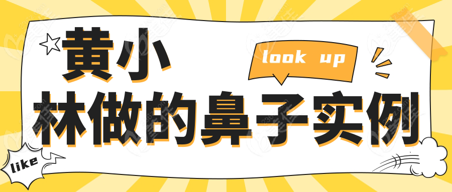 黄小林做的鼻子实例
