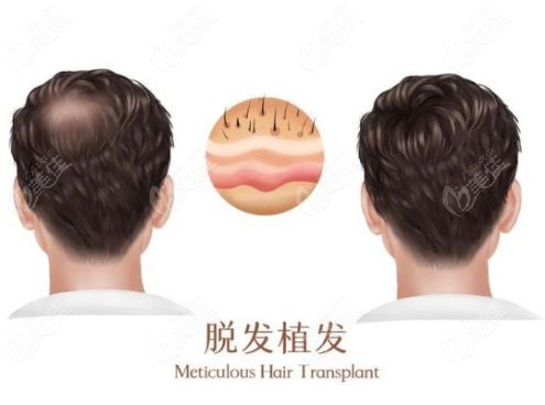 昆明源生植发医院是正规的吗