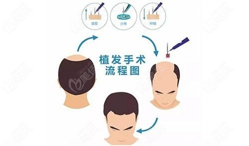 昆明源生植发评价如何