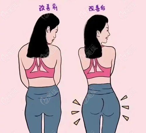 国内丰臀腻害的三大医生