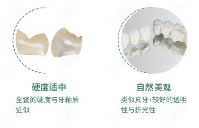 武汉镶牙多少钱一颗