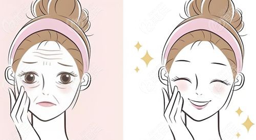 刘远程筋膜提升是正规的吗