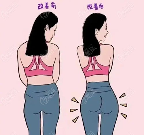 杭州假体丰臀好的医生top10榜单