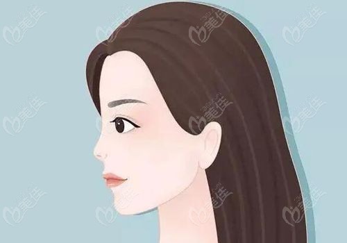 范荣杰鼻修复经典实例