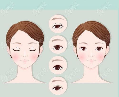 南京华美石恒做眼睛怎么样