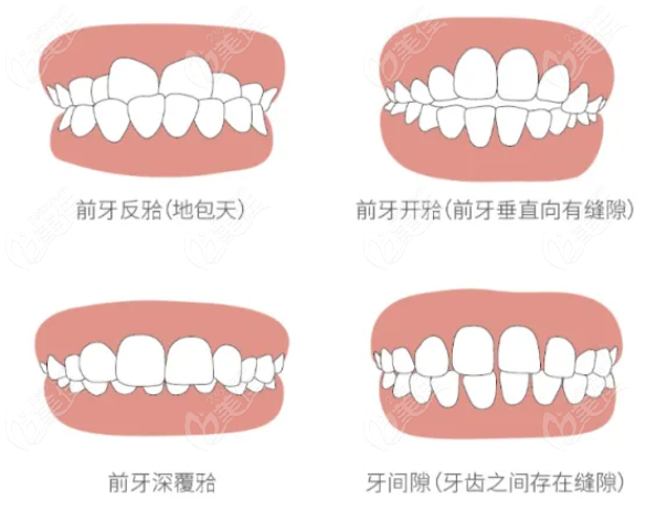王家湾咿呀口腔牙齿矫正收费一览表