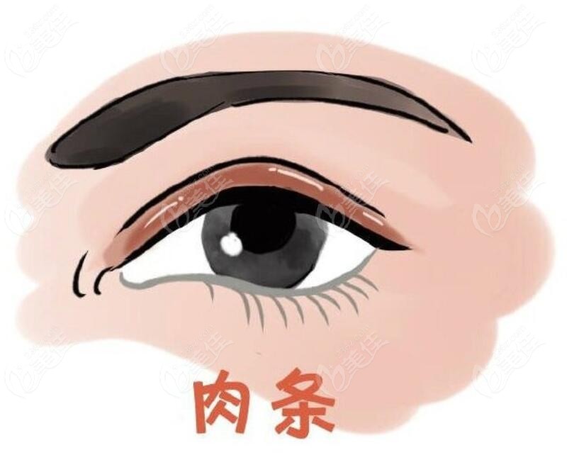 安洪宾双眼皮疤痕修复能修复好