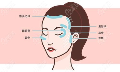 国内面部提升三件套好的医生技术趋势