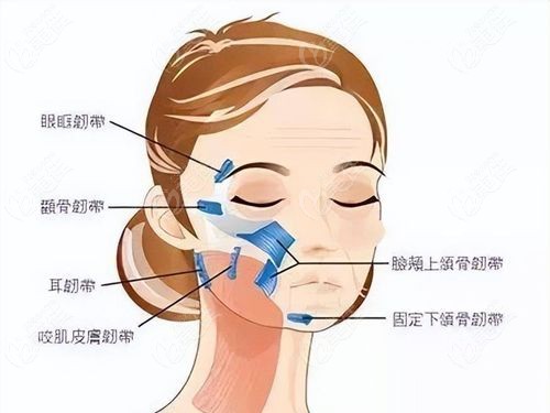 面部提升三件套是哪三样