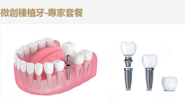 深圳鵬程口腔種牙門市價 