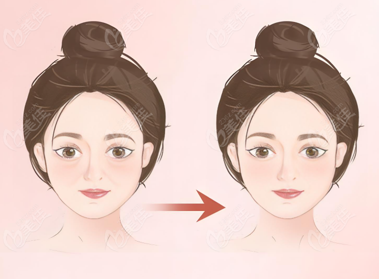杨胤恒修复馒化脸
