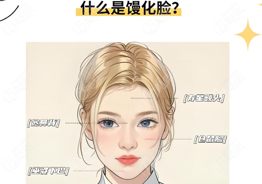什么是馒化脸