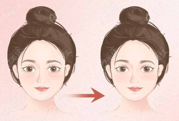 吴贞跃馒化脸修复没有失败实例