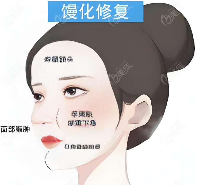 上海吴贞跃医生馒化脸修复联系方式