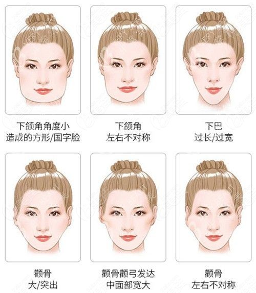 刘正茂医生磨骨黑料