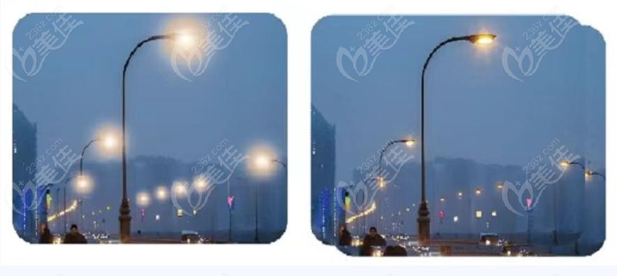 武汉爱尔眼科成功实施龙晶PR手术