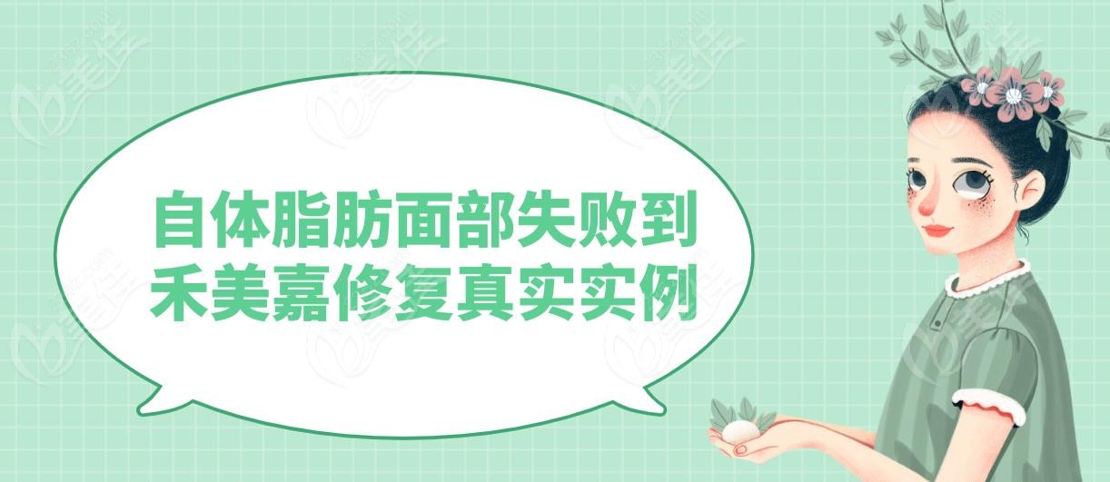 自体脂肪面部失败到禾美嘉修复真实实例