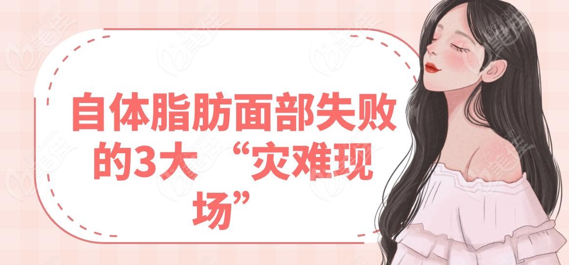 自体脂肪面部失败的3大 “灾难现场”