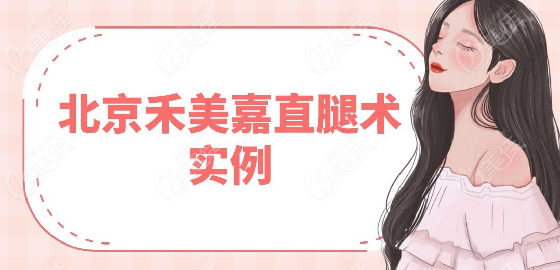 北京禾美嘉直腿术实例