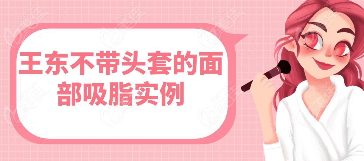 王東不帶頭套的面部吸脂實(shí)例