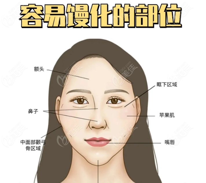吴贞跃医生馒头脸修复是正规的