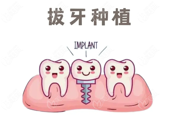 武汉同济口腔医院种植牙价格表