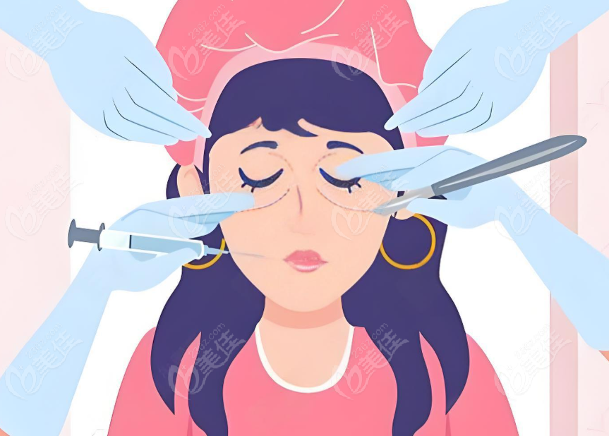 王恒的雙眼皮修復(fù)是不是靠包裝