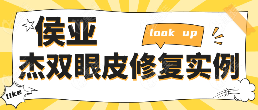 侯亚杰双眼皮修复实例