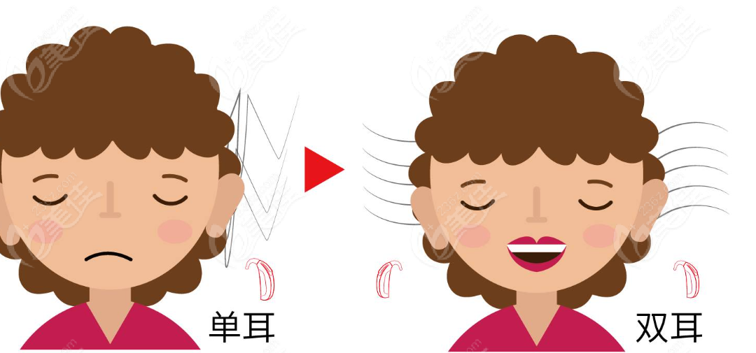 王江允做全耳再造的成效图