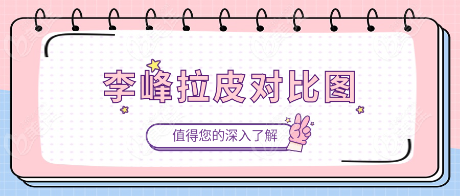 李峰拉皮对比图