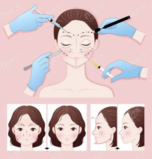 成都华美紫馨栖颜口碑实证