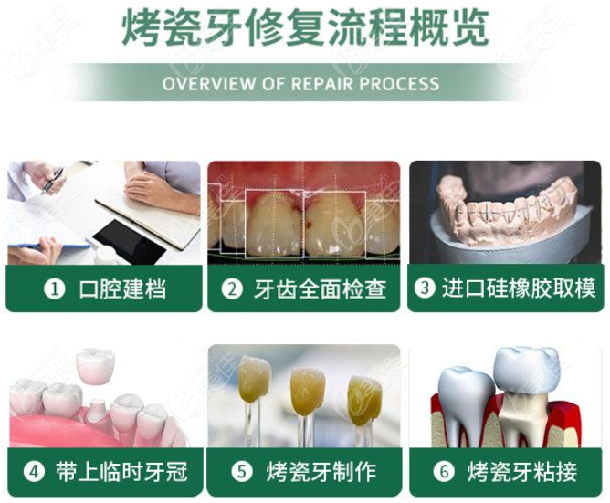 荆州中诺口腔医院烤瓷牙与全瓷牙价格