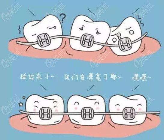 武汉同济医院正畸哪个医生好