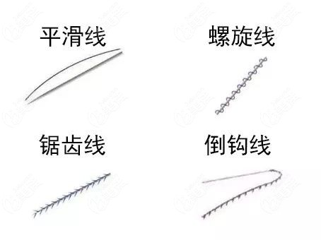 pdo和ppdo线有什么区别