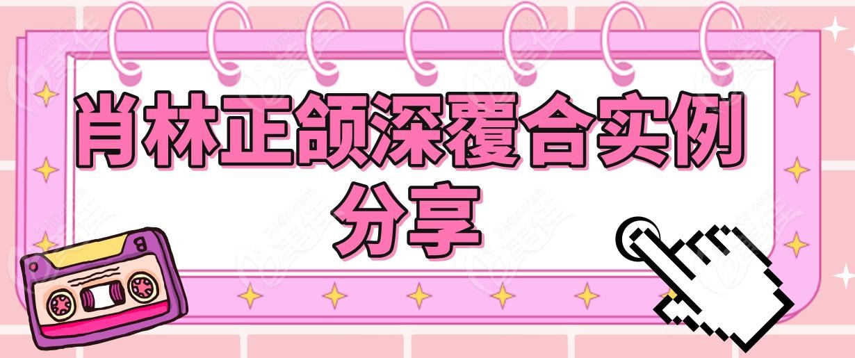 肖林正颌深覆合实例分享