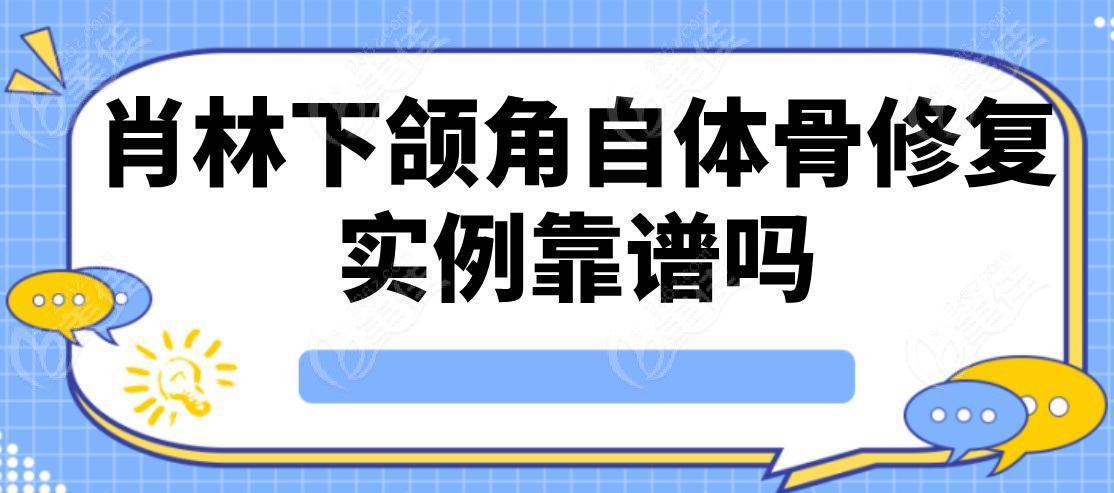 肖林下颌角自体骨修复实例靠谱吗