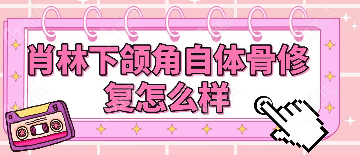 肖林下颌角自体骨修复怎么样
