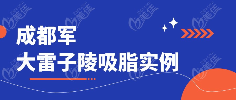成都军大雷子陵吸脂实例