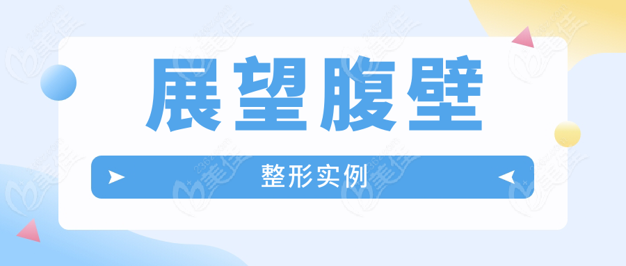 展望腹壁整形实例