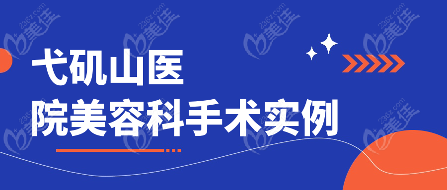 弋矶山医院美容科手术实例