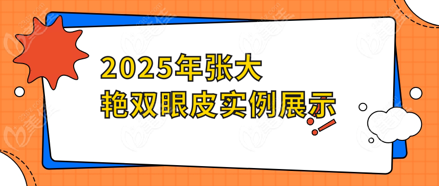 2025年张大艳双眼皮实例展示