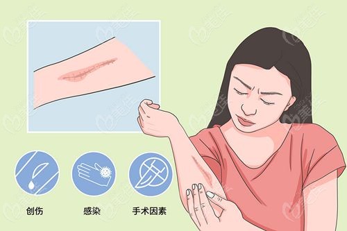 武汉治疗疤痕疙瘩哪个医院好