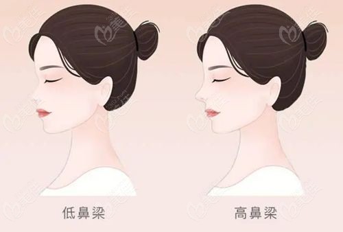 上海华美李健做鼻综合怎么样