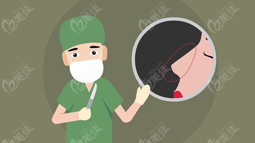 我的鼻修复重生实录