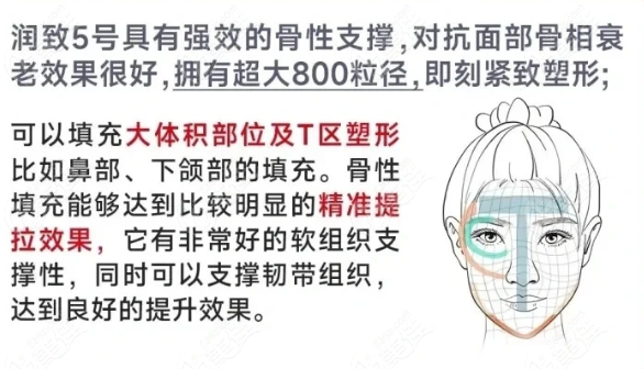 润致5号玻尿酸怎么样