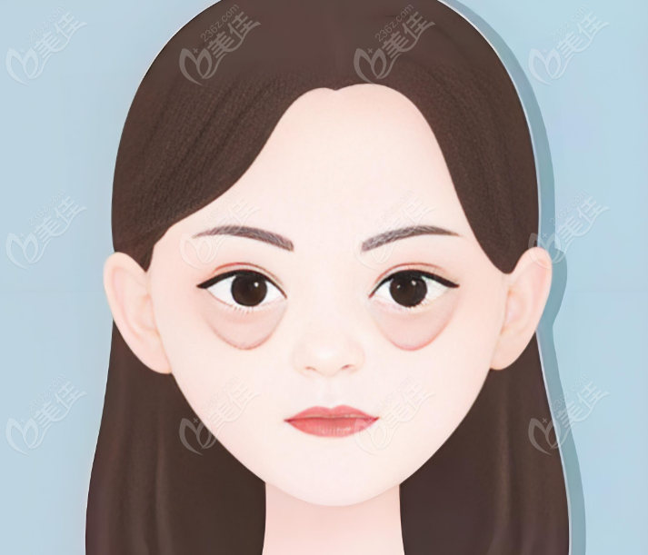 张晋宝医生眼袋修复技术