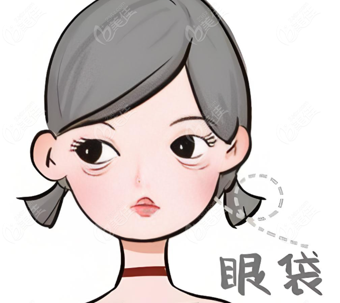 张晋宝医生不开刀去眼袋