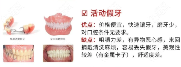 活动义齿