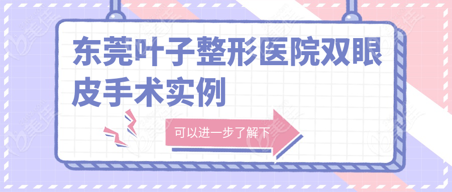 东莞叶子整形医院双眼皮手术实例